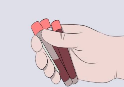 广州助孕公司：做试管打促排针是什么感觉,试管促排卵针什么时候打最好