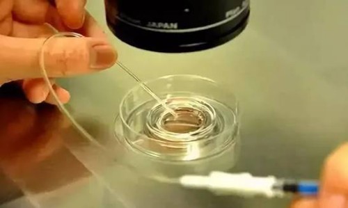 试管婴儿移植后尽量别憋尿，作用不大还可能会影响胚胎